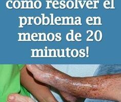 Remedio Natural para Mejorar la Circulación de las Piernas en Casa